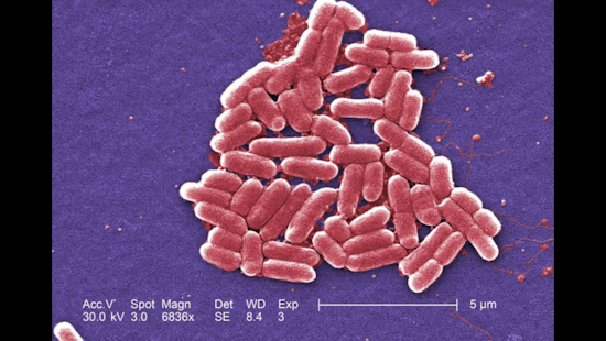 E. Coli Outbreak Strikes San Diego's Miguel's Cocina, 13 Cases Linked to Local Eatery