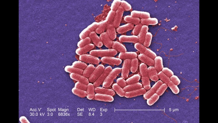 E. Coli Outbreak Strikes San Diego's Miguel's Cocina, 13 Cases Linked to Local Eatery