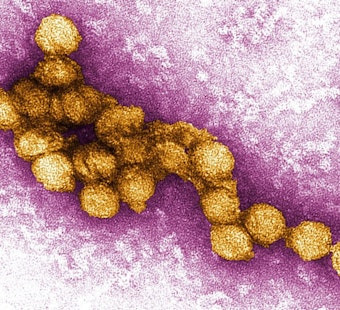 West Nile Virus Detected in Newbury Park Bird, Ventura County Authorities Intensify Mosquito Control Efforts