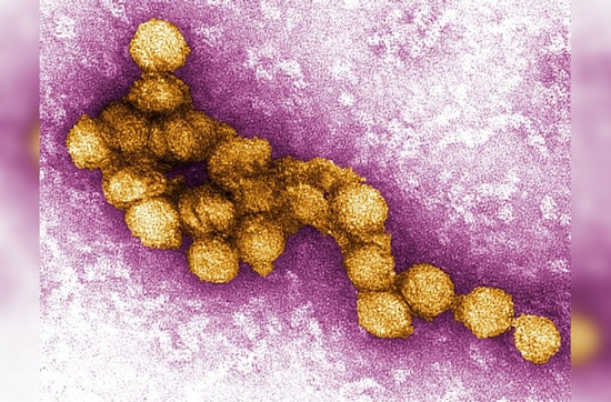 West Nile Virus Detected in Newbury Park Bird, Ventura County Authorities Intensify Mosquito Control Efforts