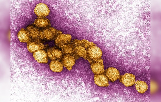 West Nile Virus Detected in Newbury Park Bird, Ventura County Authorities Intensify Mosquito Control Efforts
