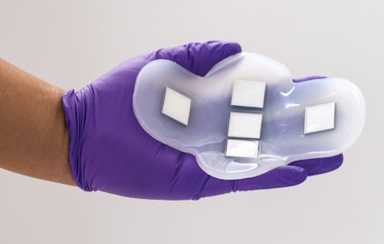 Revolutionary MIT Wearable Ultrasound Patch Promises to Transform Bladder and Kidney Health Monitoring