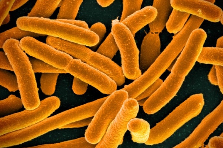 Texas Scientists Unlock E. coli's 'Memory', Iron Out New Path in Antibiotic Resistance War