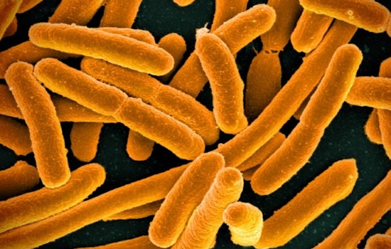 Texas Scientists Unlock E. coli's 'Memory', Iron Out New Path in Antibiotic Resistance War
