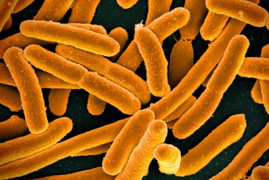 Texas Scientists Unlock E. coli's 'Memory', Iron Out New Path in Antibiotic Resistance War