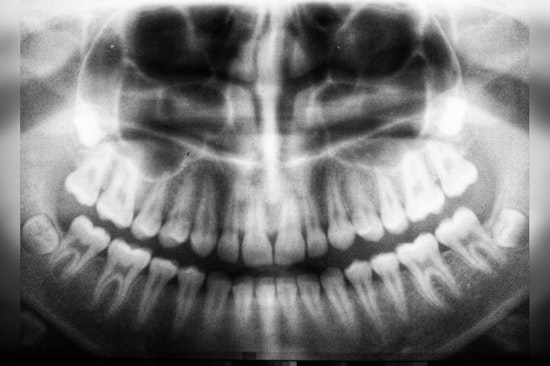 Tufts University and American Academy of Oral and Maxillofacial Radiology Declare Lead Aprons Obsolete for Dental X-rays