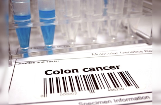 Colon Clear-Cut, MIT Study Finds Screening Slash Cancer Risk by Double Digits!
