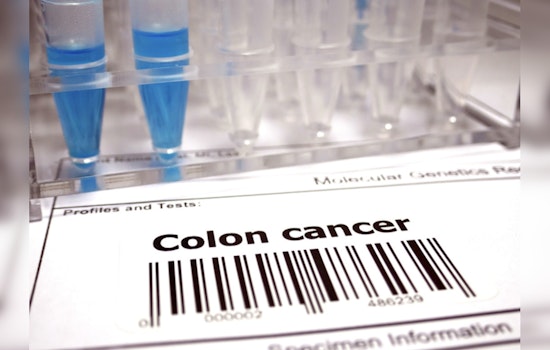 Colon Clear-Cut, MIT Study Finds Screening Slash Cancer Risk by Double Digits!