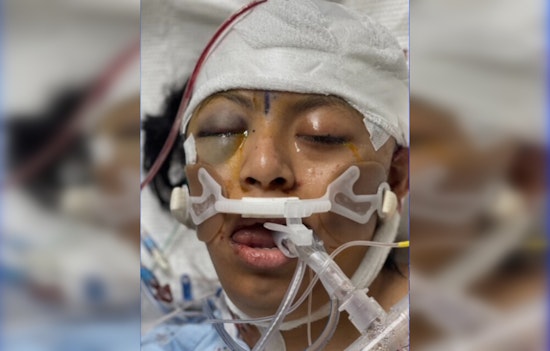 Los Angeles Community Urged to Help Identify Woman in ICU Following Hit-and-Run