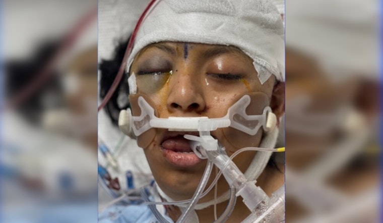 Los Angeles Community Urged to Help Identify Woman in ICU Following Hit-and-Run