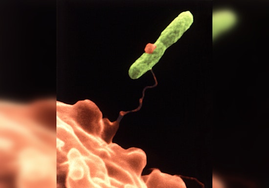 Massachusetts Resident Dies, Another Infected After Staying at New Hampshire Resort Linked to Legionnaires' Outbreak