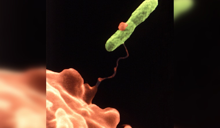 Massachusetts Resident Dies, Another Infected After Staying at New Hampshire Resort Linked to Legionnaires' Outbreak
