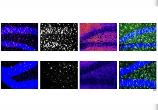 MIT Brainwaves, Scientists Nano-Target Alzheimer's with Pioneering RNA Therapy