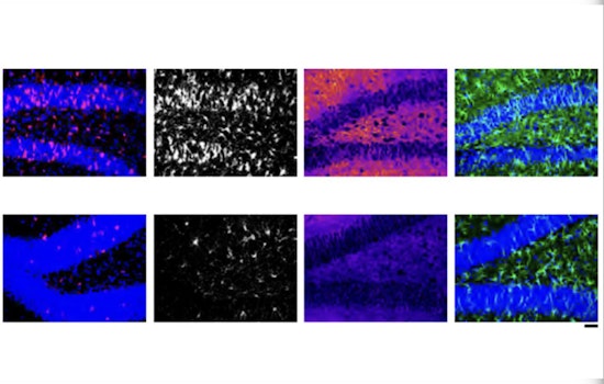MIT Brainwaves, Scientists Nano-Target Alzheimer's with Pioneering RNA Therapy