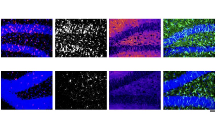 MIT Brainwaves, Scientists Nano-Target Alzheimer's with Pioneering RNA Therapy