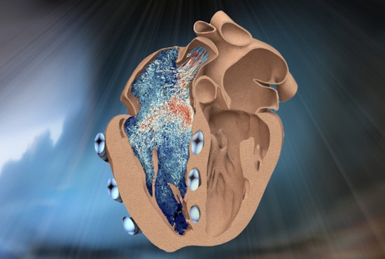 MIT Engineers Pump Up Heart Research with Innovative Robotic Ventricle