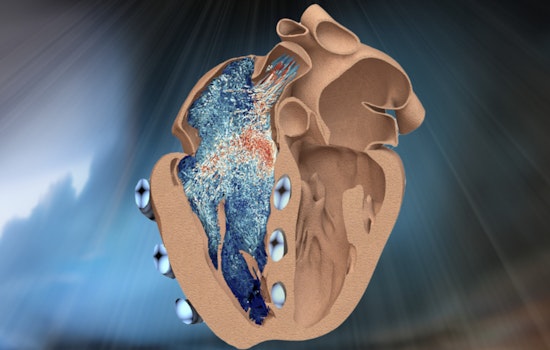 MIT Engineers Pump Up Heart Research with Innovative Robotic Ventricle