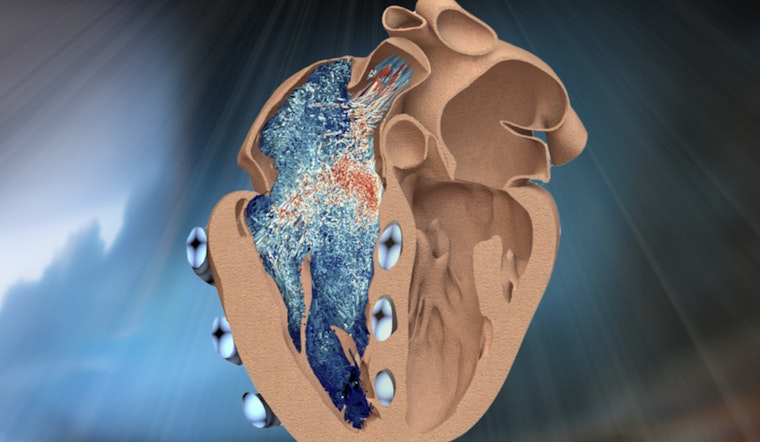 MIT Engineers Pump Up Heart Research with Innovative Robotic Ventricle