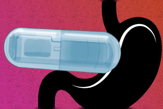 MIT's Vibrating Pill Tricks Brain into Feeling Full, Paving New Paths in Weight-Loss War
