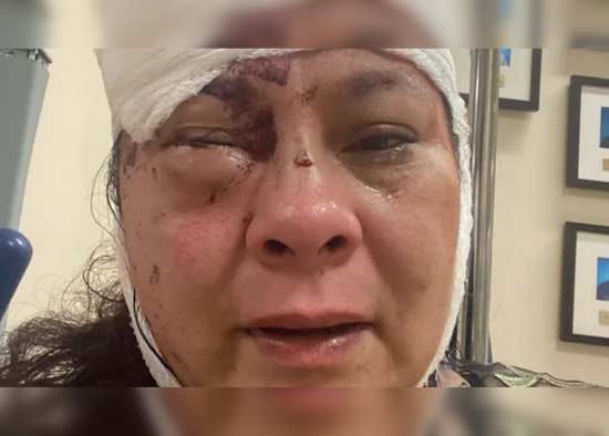 Mom of Two Fights Off Knife-Wielding Cyclist in Grisly Long Beach Assault