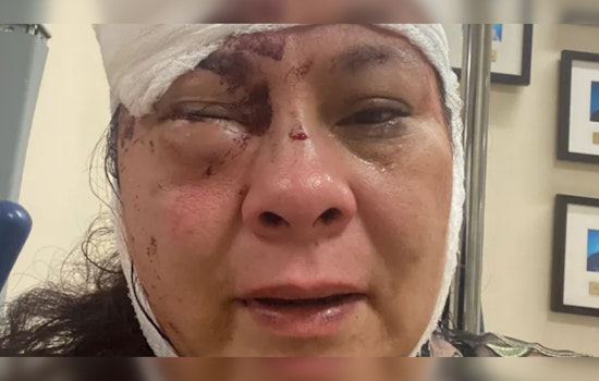 Mom of Two Fights Off Knife-Wielding Cyclist in Grisly Long Beach Assault