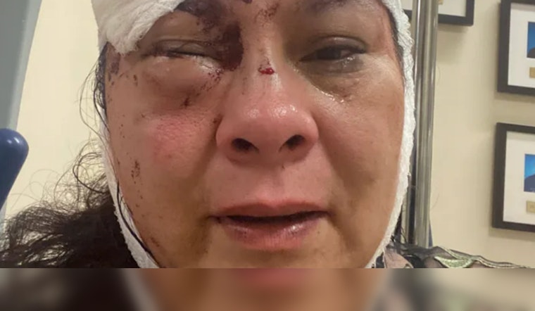 Mom of Two Fights Off Knife-Wielding Cyclist in Grisly Long Beach Assault