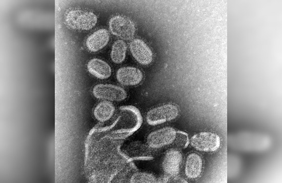 Riverside County Child's Tragic Flu Death Prompts Urgent Vaccination Plea from Health Officials
