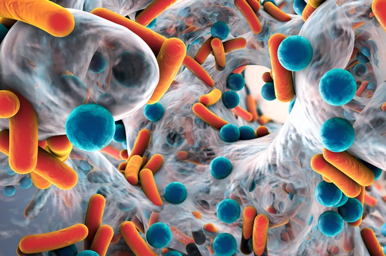 UMass Amherst Scientists' Breakthrough, New Test May Disarm Deadly Superbugs Without Triggering Resistance