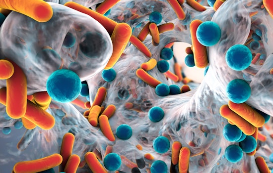 UMass Amherst Scientists' Breakthrough, New Test May Disarm Deadly Superbugs Without Triggering Resistance