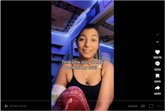 San Jose Martial Arts Instructor's Shares Story on TikTok of Skull Removal Due to a Sinus Infections: Unusual Symptoms Not to Overlook