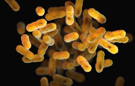 Spa Deaths: Legionnaires' Disease Suspected at Richmond Spa