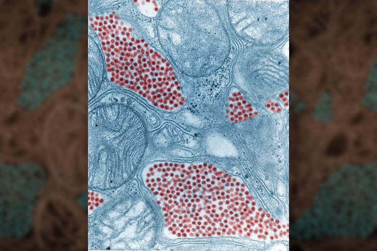 Eastern Equine Encephalitis Virus Found in Worcester Mosquitoes Threatens Massachusetts' End of Summer