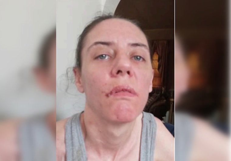 Search Underway for Missing Chicago Woman with Epilepsy and Behavioral Disorders