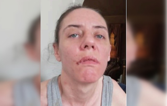 Search Underway for Missing Chicago Woman with Epilepsy and Behavioral Disorders