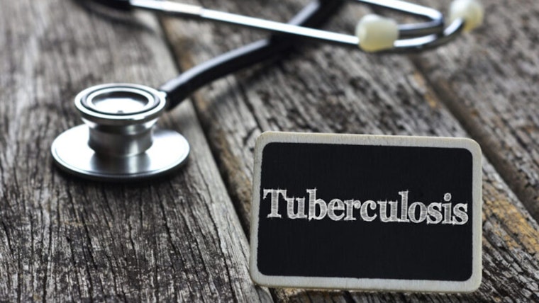 TB Scare at San Diego State University