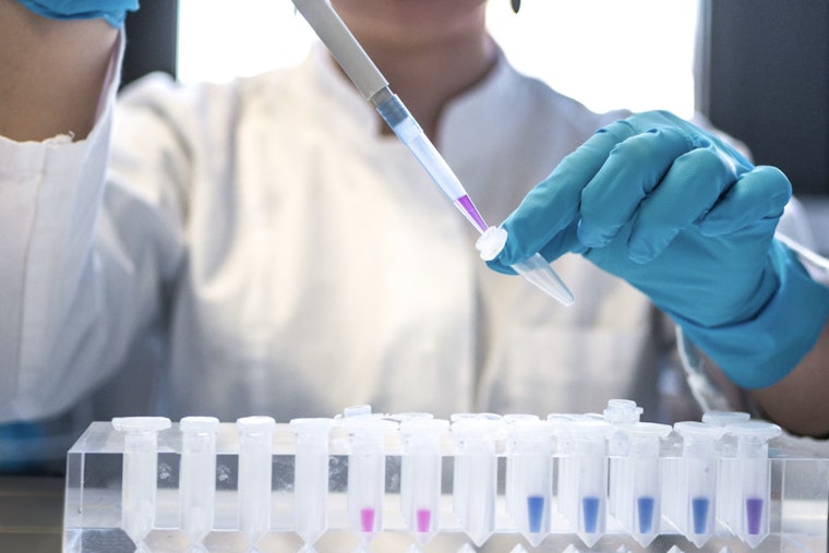 Arizona Faces 20% Spike in HIV Cases, Largest Increase Since 1980s, State Amplifies Testing and Prevention Efforts