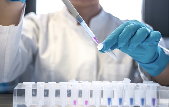 Arizona Faces 20% Spike in HIV Cases, Largest Increase Since 1980s, State Amplifies Testing and Prevention Efforts