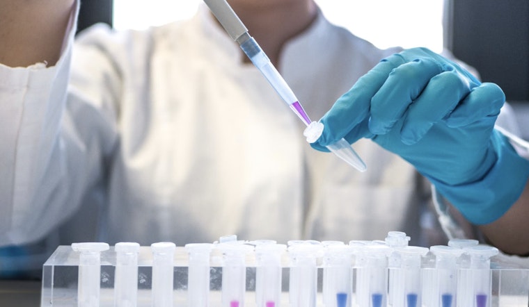 Arizona Faces 20% Spike in HIV Cases, Largest Increase Since 1980s, State Amplifies Testing and Prevention Efforts