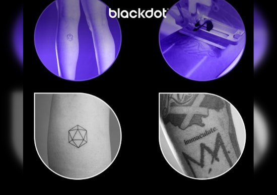 Austin's Blackdot Revolutionizes Tattoo Scene with Pioneering Automatic Device