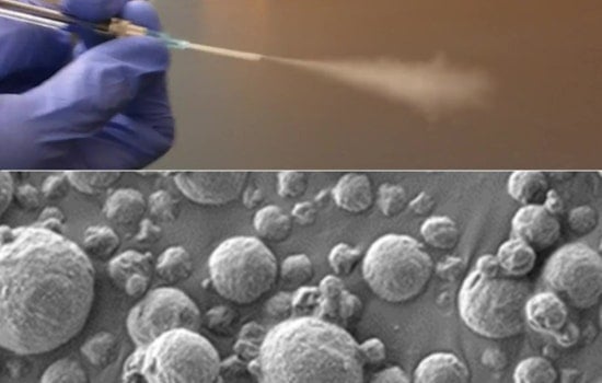 MIT Breathes New Hope: Inhalable Nanosensors Could Revolutionize Lung Cancer Screening