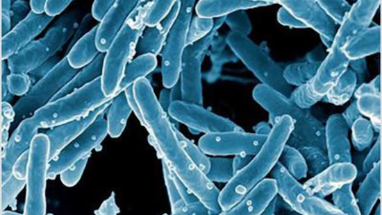 Surge in Tuberculosis Cases Concerns Santa Clara County, New Clinic Aims to Tackle Public Health Challenge