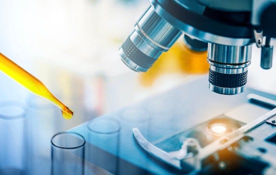 Urine Luck! San Antonio Scientists Spot Breakthrough Molecule Predicting Diabetic Kidney Failure