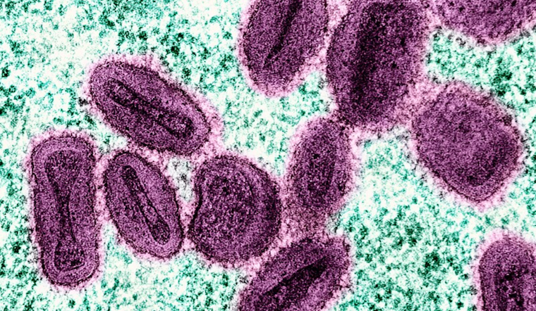 El Paso Health Officials Confirm Two Cases of Mpox, Urge Preventive Measures Amid Contact Tracing Efforts