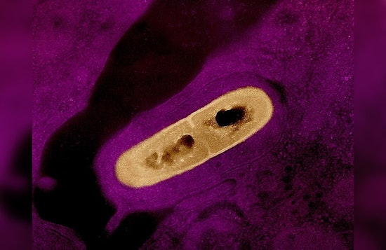 MEGA MEAT RECALL! 12 Million Pounds of Listeria-Linked BrucePac Products Hit Schools, Costcos and Walmarts Nationwide