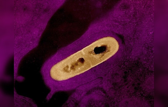 MEGA MEAT RECALL! 12 Million Pounds of Listeria-Linked BrucePac Products Hit Schools, Costcos and Walmarts Nationwide