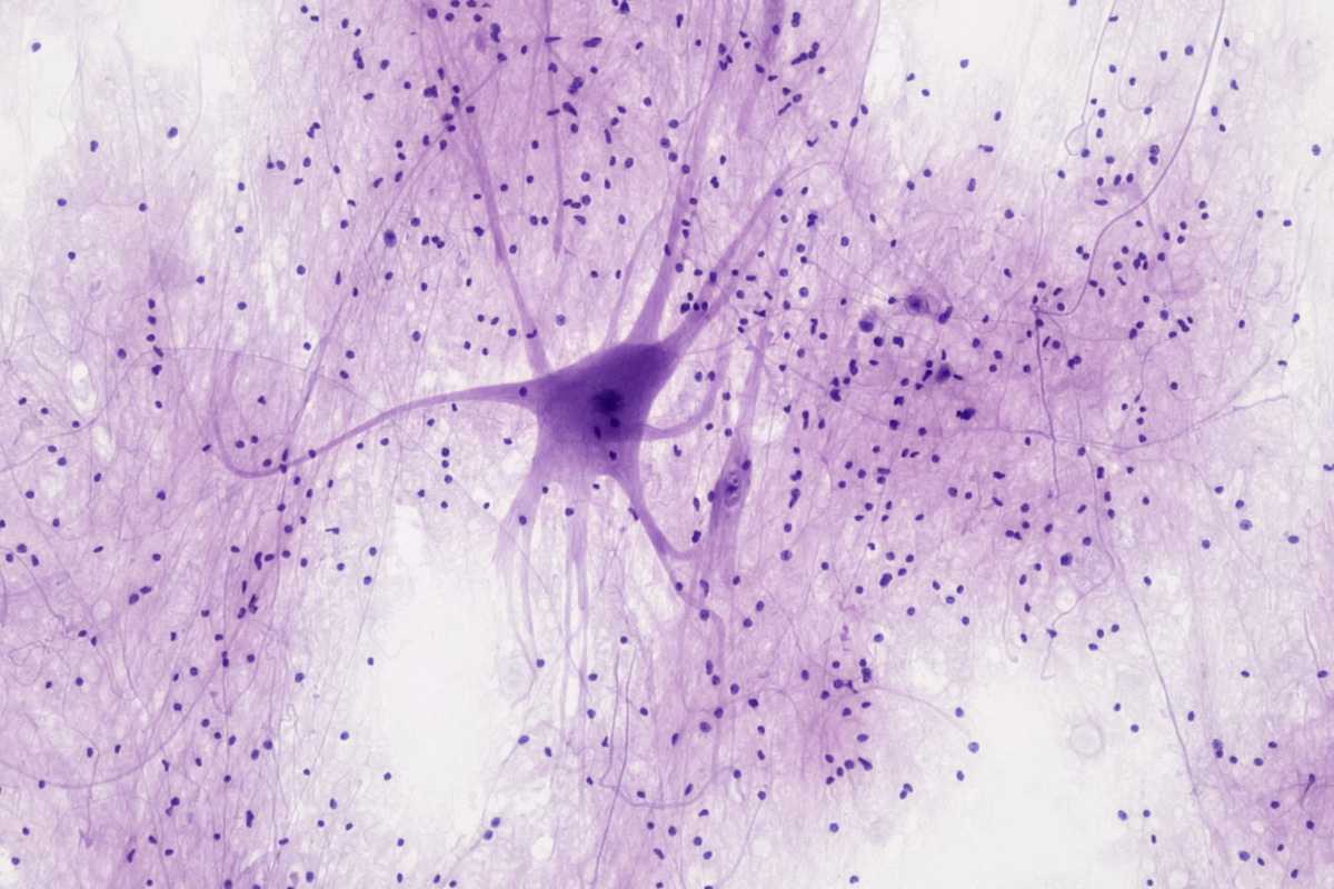 MIT Scientists Spark Tech Revolution with Cell-Sized Wearables