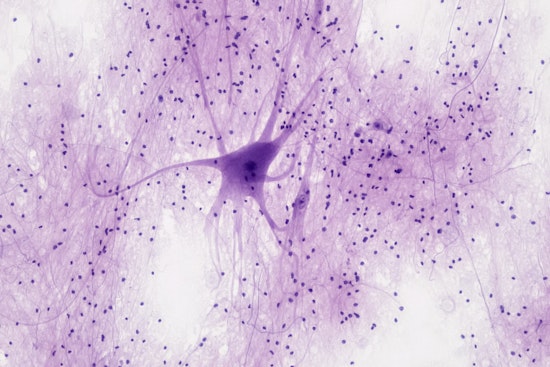 MIT Scientists Spark Tech Revolution with Cell-Sized Wearables Innovating Neuronal Health