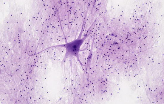 MIT Scientists Spark Tech Revolution with Cell-Sized Wearables Innovating Neuronal Health