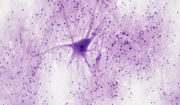 MIT Scientists Spark Tech Revolution with Cell-Sized Wearables Innovating Neuronal Health