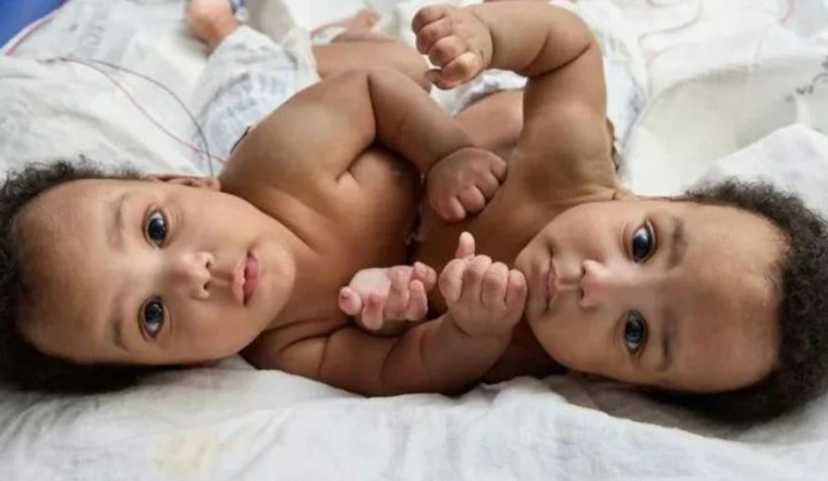 Philadelphia Surgeons at CHOP Celebrate Successful Separation of Conjoined Twins in Milestone Operation